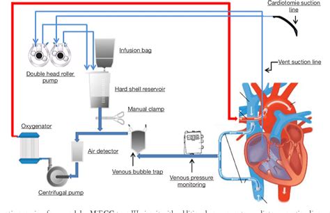 centrifugal pump bypass|From Experience .